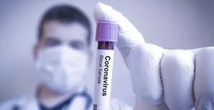 Coronavirüsü Testi Sonuçları! e-Nabız Coronavirüsü Test Sonuçları Öğrenme