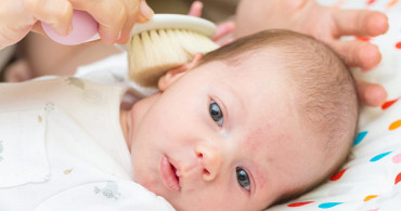 Bebeklerde Konak Belirtisi Nelerdir?