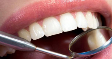 Diş Estetiği Hakkında Yanlış Bilinenler
