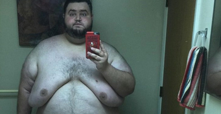 Morbid Obezite Hastası Gencin 108 Kilo Verdikten Sonra Yaşadığı İnanılmaz Değişim