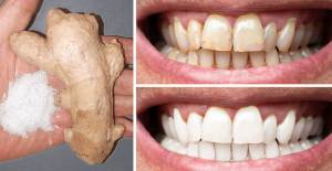 Dişlerinizi Pratik Bir Şekilde Evde Daha Beyaz Yapmanın 8 Doğal Yolu