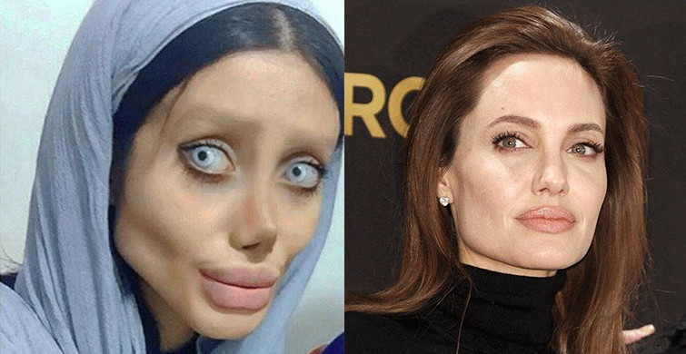 Angelina Jolie’ye Benzemek Uğruna Sayısız Operasyon Geçiren İranlı Kadın: Sahar Tabar