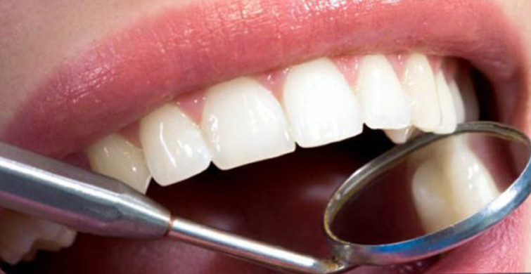 Diş Estetiği Hakkında Yanlış Bilinenler