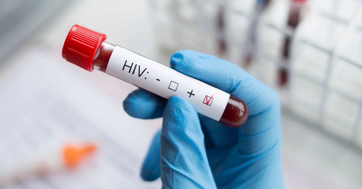 HIV nedir?