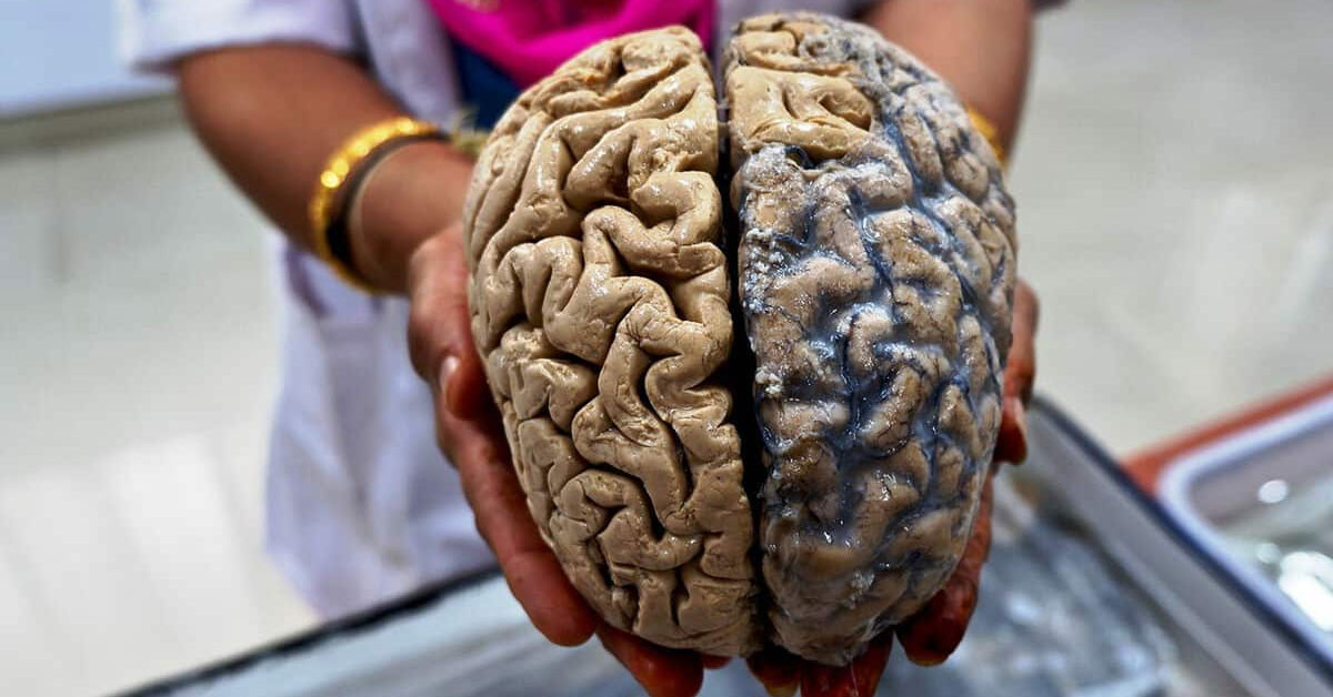 İnsan beyninin en net görüntüsüne ulaşıldı