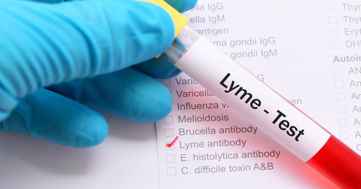 Lyme Hastalığı