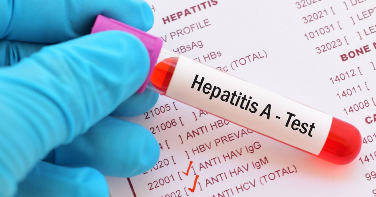 Hepatit A nasıl geçer?