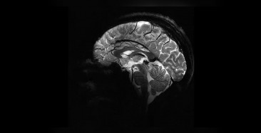 İnsanın gizemli organı beynin en net görüntüsüne ulaşıldı!