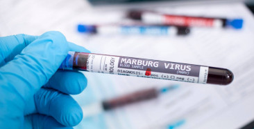 Marburg virüsü nedir, ölümcül mü? Marburg virüsü belirtileri neler, tedavisi var mı? Dünyanın en ölümcül virüsü yeniden ortaya çıktı