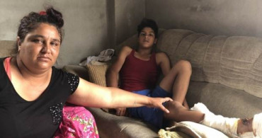 Adana'da 13 Yaşındaki Çocuğa Pitbull Saldırınca Ortaya Dehşet Görüntüler Çıktı