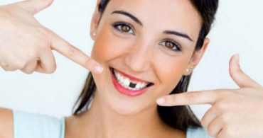 Ağızda Eksik Diş Hangi Hastalıklara Davetiye Çıkarıyor? Eksik Diş Sağlam Dişleri Etkiler mi?