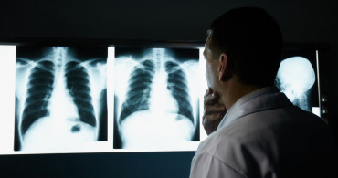 Akciğer Kanseri Nedir, Belirtileri Nelerdir?