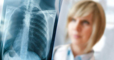 Akciğer Kanseri Taraması Nasıl Yapılır? 