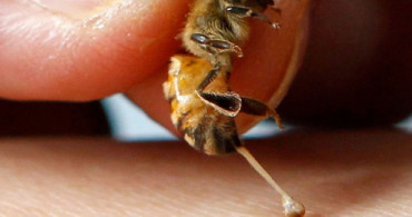 Arı Sokmalarında İlk Müdahale Nasıl Yapılır? Arı Sokması Tehlikeli midir?