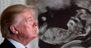 Bebeğinin Ultrason Görüntüsünün Trump'a Benzediğini Gören Anne Şok Oldu!
