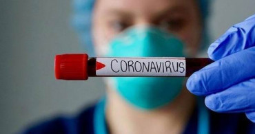Beklenen Rapor Yayınlandı! ‘Koronavirüs İnsan Yapımı’