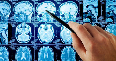 Beyin Cerrahisinde ‘Nöronavigasyon' Sistemi