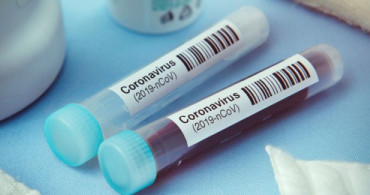 Cezayir'de Coronavirüse Yakalanan Kişi Sayısı 19’a Çıktı