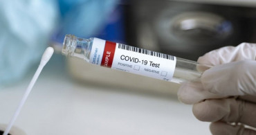 Çinli Araştırmacılardan Yeni Buluş: Koronavirüs Testi 4 Dakikada Sonuçlanıyor!
