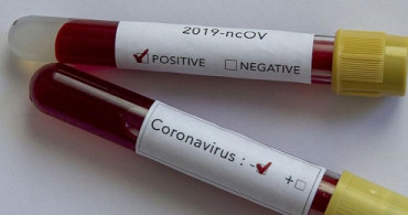 Coronavirüs Sindirim Yoluyla Bulaşıyor mu ?
