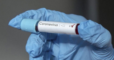 Coronavirüsü Belirtileri Nelerdir ve Nasıl Anlaşılır? Uzman İsim Coronavirüsü Yeni Belirtileri Açıkladı! İşte COVID-19 Belirtileri!