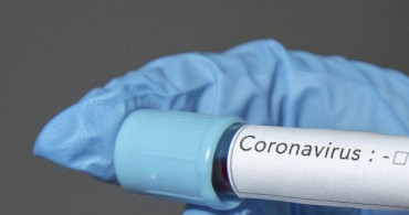 Çorum Valiliğinden Coronavirüs Açıklaması