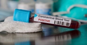 Danimarka'da  Coronavirüs Sebepli İlk Ölüm