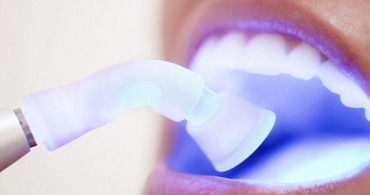 Diş Beyazlatmada Sirke Yöntemi Nedir? Sirke ile Nasıl Diş Beyazlatılır?
