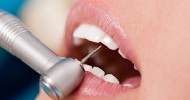 Diş Kanal Tedavisinde Ağrı Ne Kadar Sürer? 