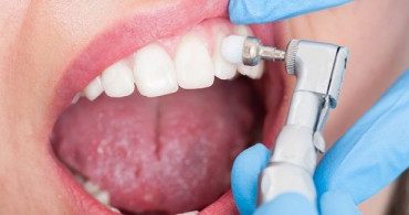 Diş Taşı Temizliği Acıtır mı? Diş Taşı Temizliği Ne Sıklıkla Yapılmalıdır?