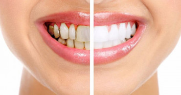 Diş Tozu Nasıl Yapılır? Evde Naneli Diş Tozu Yapımı