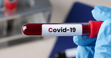 Dünya Genelinde Coronavirüse Yakalanan Kişi Sayısı 11,5 Milyonu Geçti