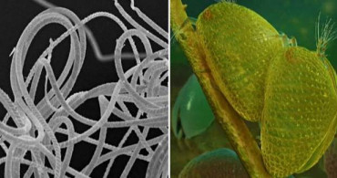 Dünyanın, 100 Milyon Yaşındaki En Eski Hayvan Spermi Keşfedildi