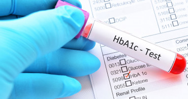 HbA1c nedir, normal değeri kaç olmalı, tedavisi nasıl yapılır?  Şeker hastalarının kabusu HbA1c yüksekliği hakkında bilmeniz gerekenler 