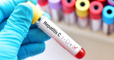 Hepatit C nedir, nasıl bulaşır, aşısı var mı? Hepatit C'den korunma yolları
