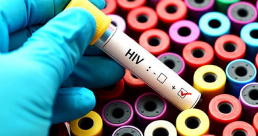 HIV Virüsü Nedir? HIV Virüsü Nasıl Bulaşır? 