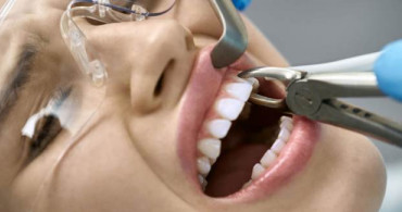 Kanserli Hasta Diş Çektirebilir Mi?