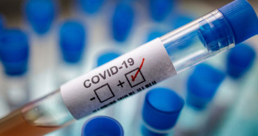 Koronavirüs haftalık tablosunda son durum? Sağlık Bakanlığı verileri açıkladı: Vaka ve ölümler hızla artıyor!