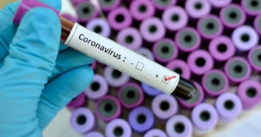 Koronavirüsün Psikolojik Etkisi Çok Büyük