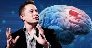 Kurgu filmleri gerçek oldu: Elon Musk ilk kez bir insana beyin çipini yerleştirdi!