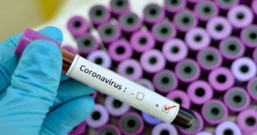 Moldova'da İlk Defa Coronavirüs Saptandı