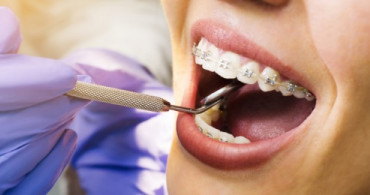 Ortodonti Hangi Hastalıklara Bakar?
