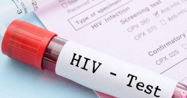 Rusya'da 38 Milyon Kişiye HIV Testi Yapıldı
