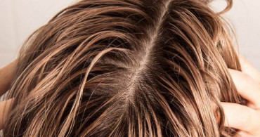 Saçın Yağlanması Nasıl Önlenir?