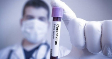 Sağlık Bakanlığı Açıkladı! Corona Virüs Nasıl Bulaşır?