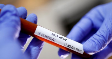 Sağlık Bakanlığı'ndan Coronavirüs Testi İçin e-Nabız Açıklaması