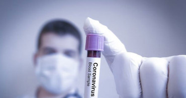 Samsun'da Taziye Ziyaretinde 21 Kişi Koronavirüse Yakalandı