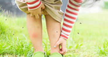 Sivrisinek Isırığı Nasıl Tedavi Edilir?