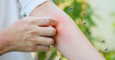 Sivrisineklerin Sevmediği Kokular Neler? Sivrisineklerden Korunmanın Yolları