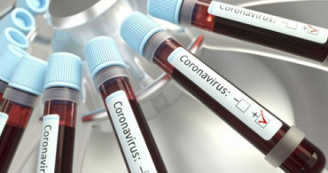 Suriye'de Coronavirüs Vakası Tespit Edildi